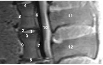Table 2. Total score values considering different MRI- sequences (1 = Spinal surgeon, 2 = Radiologist)