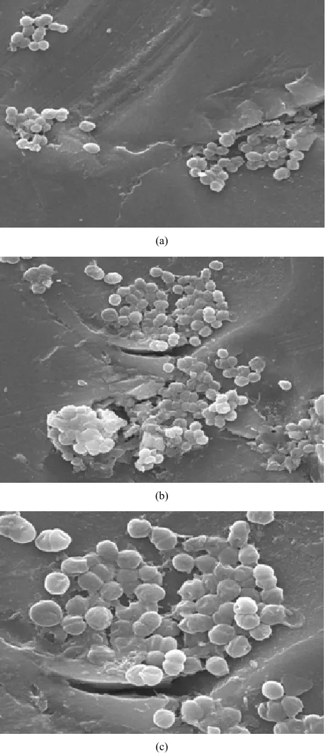 Figure 1. Scanning electron micrographs of VREF cells Mag- nification at 10,000 × 5 µm