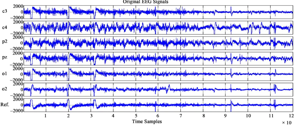 Figure 3. The original 1500 samples EEG data from C3 channel of severe OSAS patient. 