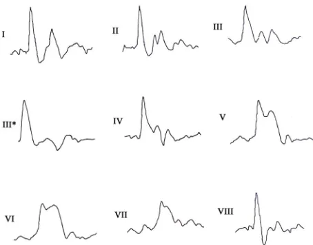 Figure 1patterns are also found in prominent clusters in an inde-