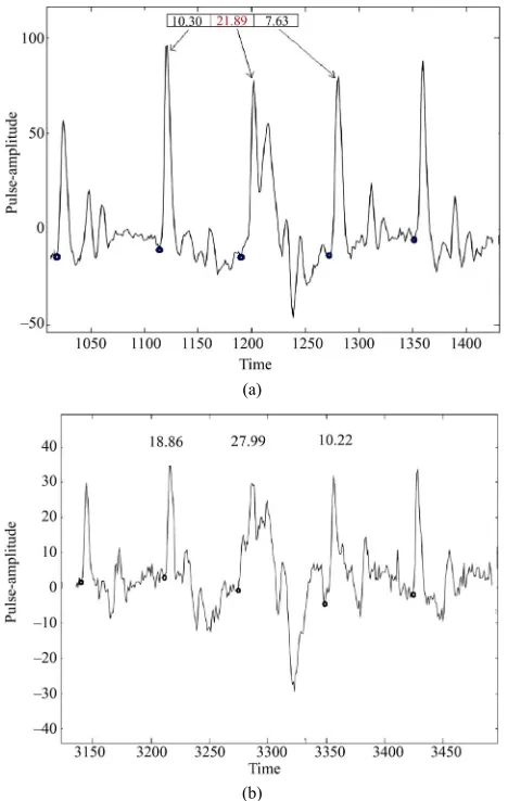 Figure 2. (a)in three consecutive periods in a pulse record (patient code: B1). The period for which FR = 27.99 is truly rare case of normal  Illustration of FR variation in different periods of pulse record (subject code no.: C43)