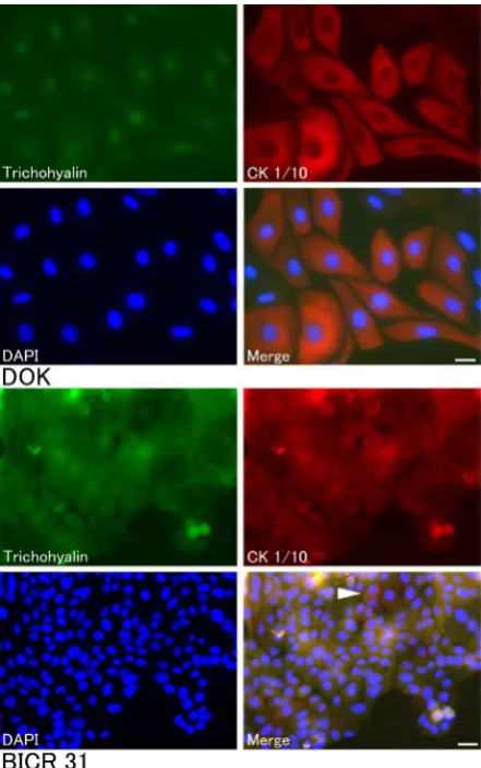 Figure 4. Immunocytochemical observations of tricho-lization of trichohyalin and CK 1/10 was observed (white localization of trichohyalin was observed in all compart-ments of DOK cells