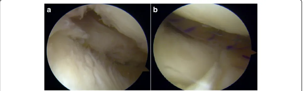 Fig. 6 A recent frontal (a) and sagittal (b) MRI Patient 2