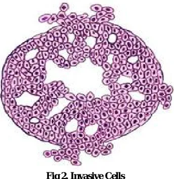 Fig 2. Invasive Cells   