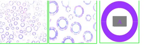 Figure 1. Amplification of different multiples of the micro- bubble morphology.  
