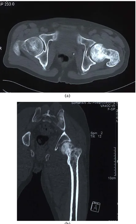 Figure 3(b)weighted image showed an inhomogeneous increase of 