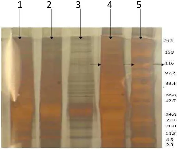 Fig. 3. staining Lane 1,2,3,4 represents the different concentrations of protein The band of HBECs for TLR9 protein in the coomassie blue samples and lane 5 represents the protein markers in kDa