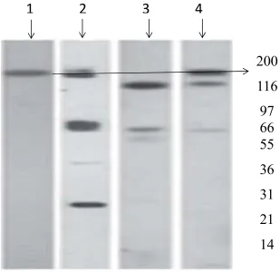 Fig. 5. representing the Western blot results of the HBECs induced with LPS.    Lanes 2, 3, 4 representing the different concentration of the protein samples and lane 