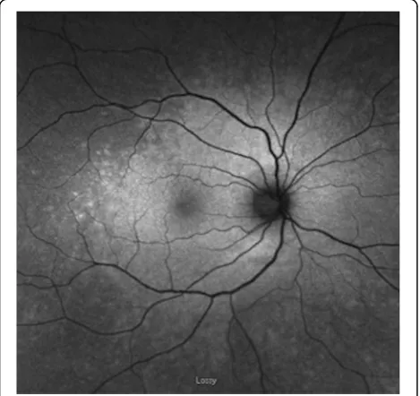Fig. 2 Fundus photography of patient with npAIR (patient 10). a Fundus photography demonstrating mild optic head nerve pallor, attenuatedvasculature, and scattered RPE changes