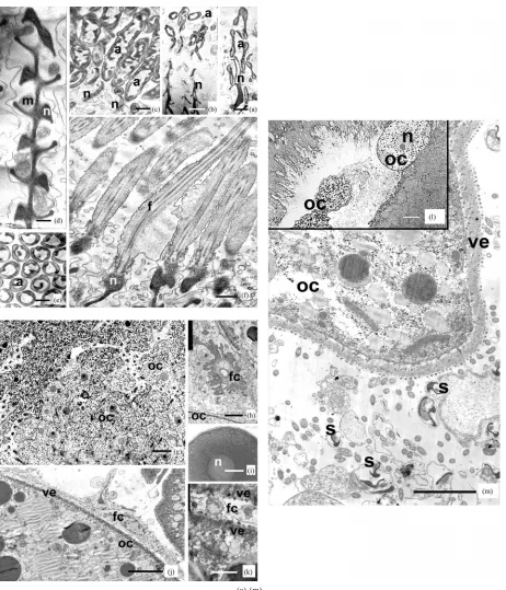 Figure. 1. Longitudinal ((a)-(d), (f)) and cross-cut (e) sections of spermatozoa of vestimentiferan Riftia pachiptilagitudinal sections of sperm acrosomes