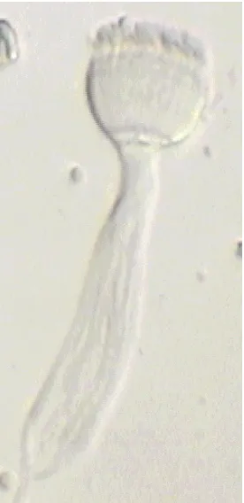 Figure 2. The sperm package of R. pachyptila in sea water has the shape of a torch. Scale: 10 µm