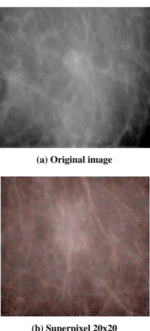 Fig. 6: Segmentation results in a mammography image without lesions. 