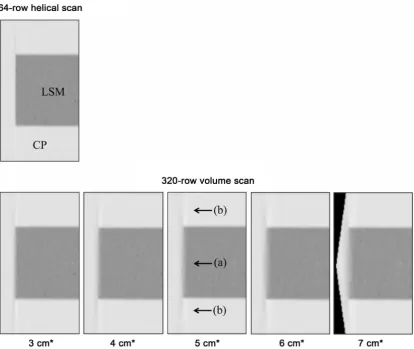 Figure 4. Placement of the ROI in the CT image to measure CT number profiles. CT image of the CSP with the simulated tumor (white arrow)
