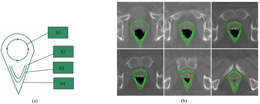 Figure 2. (a) The robust active shape model includes prostate (S1), posterior half internal anal sphincter (S2), posterior half external anal sphincter (S3), the outline borders between the prostate and rectum (S4), in which the anterior border is de-