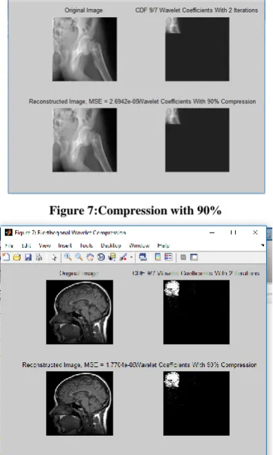 Figure 7:Compression with 90% 