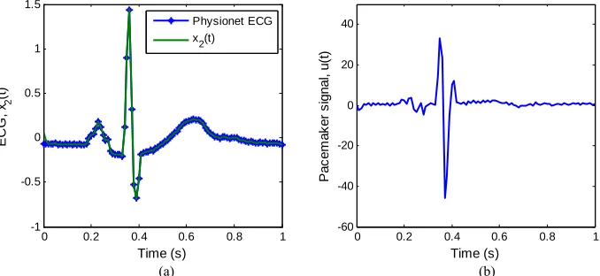 Figure 4. ECG tracking simulation results for the 2nd-order heartbeat system. (a) ECG tracking; (b) Pacemaker signal