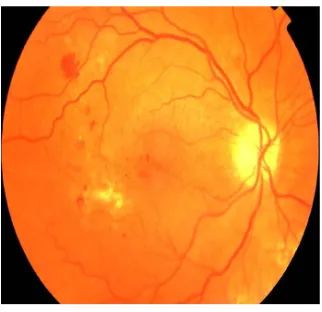 Figure 2. Retinal fundus image. 