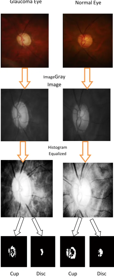 Fig 4. shows the disc and cup of various fundus images. 