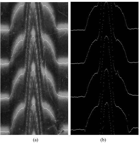 Figure 10. Experimental multiple-beam Fizeau interfero-gram in case of using optical fiber as a object; (a) Extracted fringe skeleton, shown on the background of the original interferogram; (b) Extracted fringe skeleton, shown on the dark background