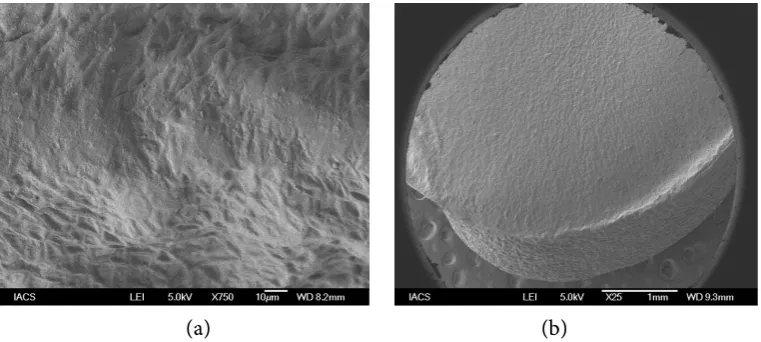 Figure 3. (a) & (b) Electron microscopic picture right hand part of the gram grain in different resolution
