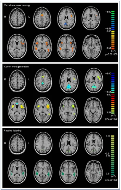 Figure 1. Whole brain group analyses of language tasks. 