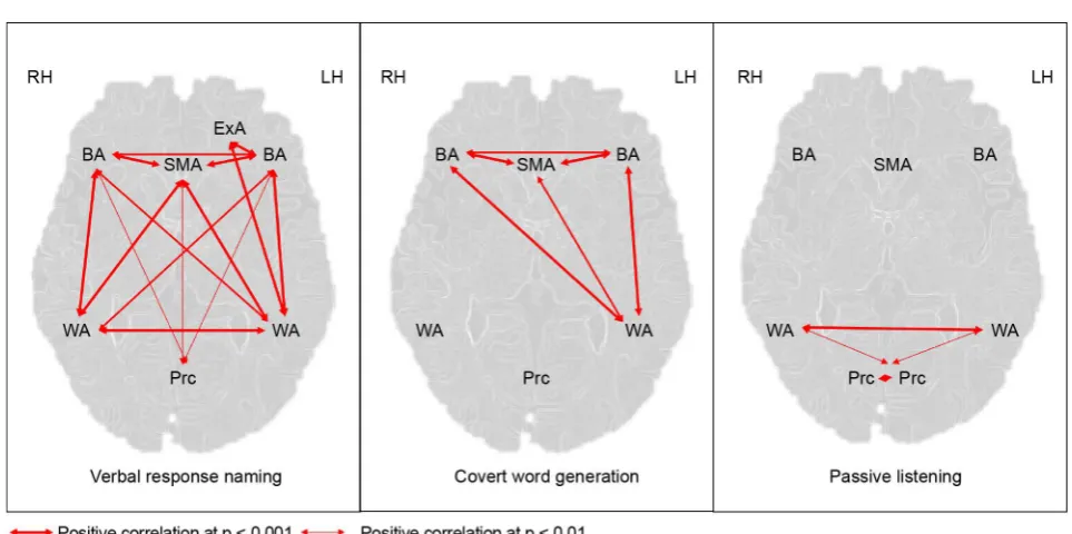 Figure 2. Functional connectivity between activated regions in the three language tasks