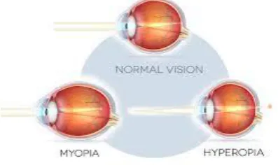 Fig 11: Eye Tracking Glasses 