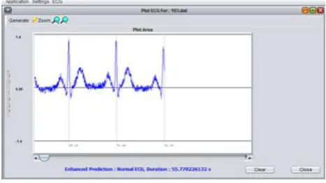 Figure 4 describes the duration time for processing ECG data. This figure output is based on deep neural network algorithm
