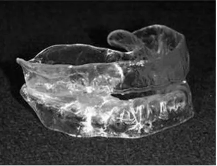 Figure 1. Mono-block type oral appliance used in present study. 