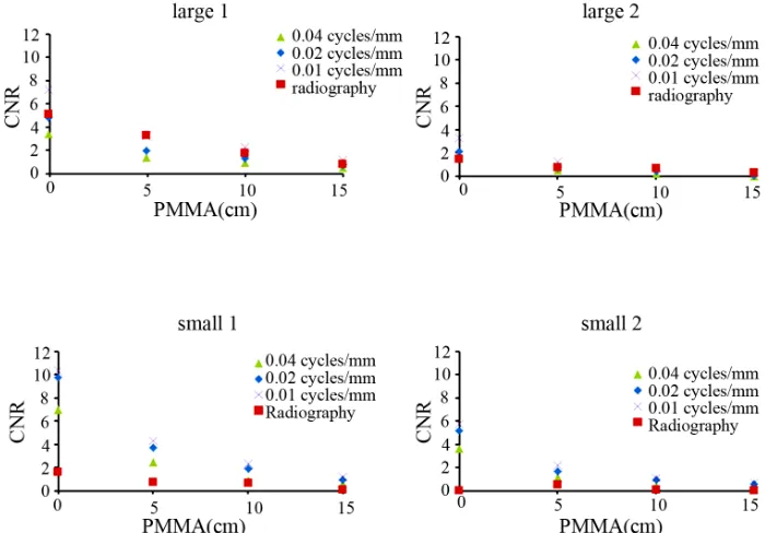 Figure 3. Comparison of detectability phantom image (bone image) with images obtained from dual-energy subtraction digi-tal tomosynthesis (cut-off frequency, 0.01 cycles/mm) of the in-focus plane, and dual-energy subtraction radiography