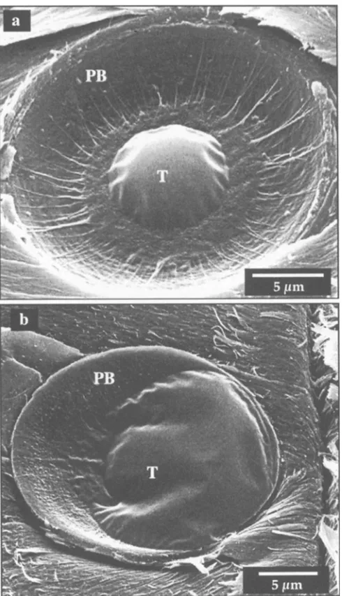 Fig. 10. Bordered pits (earlywood) of epoxy-impregnated pine sap- wood. PB, bordered pit pair; T, toms membrane 