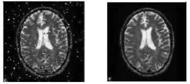 Fig. 3.3: Input and Output of Anisotropic Filter. 