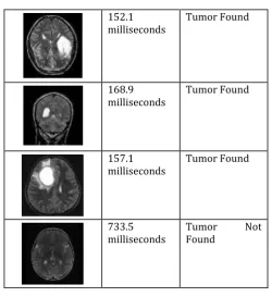 Fig. 4.3:  Resuls in Inference Tab 