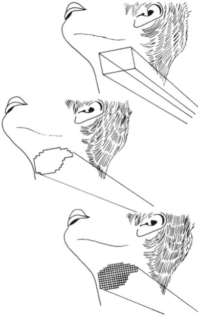 Fig . 1 .6T he diff e r e nc e s be t w e e n c o nv e nt io na l r a dio t he r a pyt he r a py( t o p) , c o nf o r ma l r a dio -C FR T( c e nt r e ) a nd C FR Tw it h int e ns it ymo dula t io n I MR T( bo t t o m) [2 3 ].