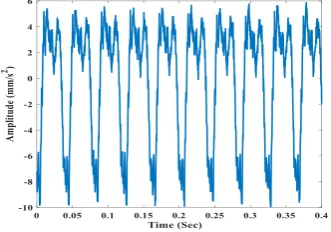 Fig. 6.  Time domain vibration signals of the synchronous machine in the state of healthy and no-load condition of the machine