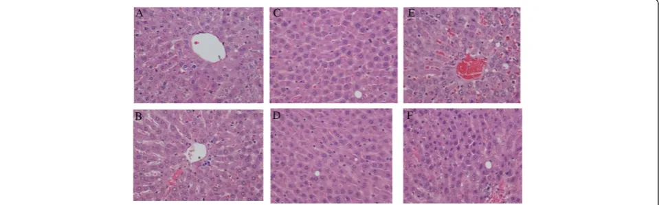Figure 1 Histopathological evaluation of liver in Rats fed Lard Based Diets. (A) Represents a normal liver with normal morphology from aeuthyroid animal which consumed a control diet