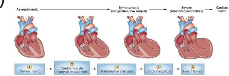 Figure 2.4: Progression of Heart Failure. A) Development of heart failure after hemodynamic overloading