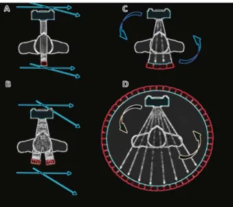 Figure 3: The first generation CT scanners (A) utilized a pencil beam fixed with a single detector moving simultaneously by translation-rotation motion