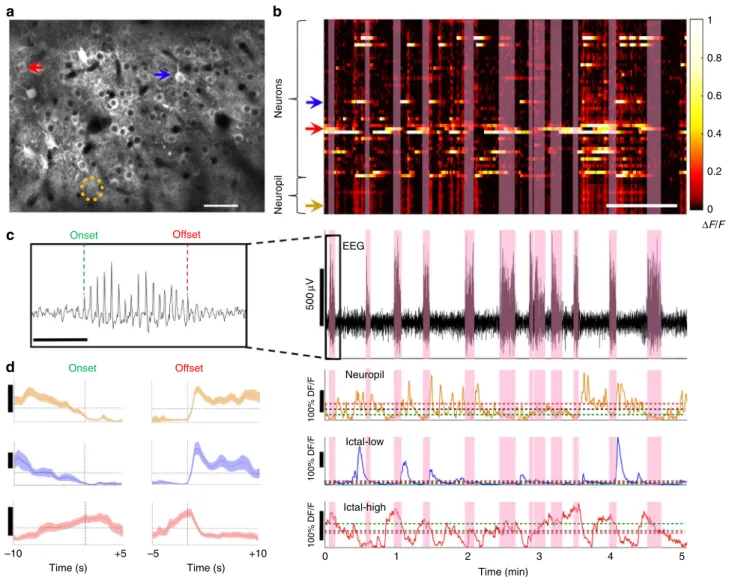 Fig. 1 In vivo 2-photon microscopy and EEG in visual cortex of stargazer mice. a Typical ﬁeld of view for in vivo imaging; GCaMP6-ﬁlled neurons in L2/3 of visual cortex (red arrow —neuron with high activity during seizures (ictal-high); blue arrow—neuron w