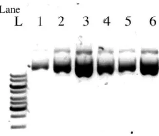 Fig -3: Agarose gel image of directional Colony PCR amplified product to determine orientation of the insert