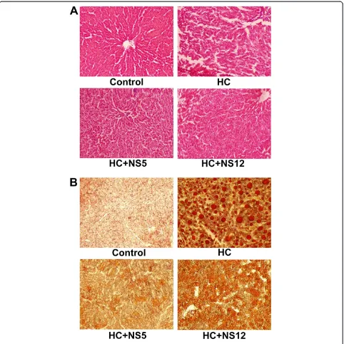 Figure 5 Effects of the two NSdelbrueckiidiet; HC: high cholesterol diet; HC + NS5: high cholesterol diet + lactobacillus strains on histology of liver in rats fed a high cholesterol diet