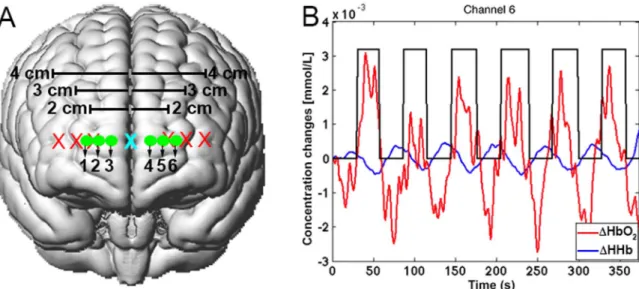 Fig. 8. Channels conﬁguration and regions of interest. Regions of interest were deﬁned on the basis of the Brodmann Area atlas.
