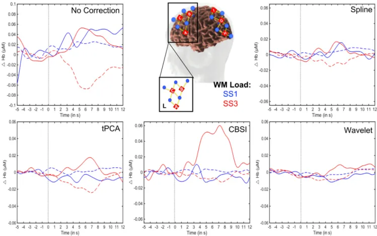 Figure 9 shows the quantitative metrics across comparisons relative to the data with no motion correction