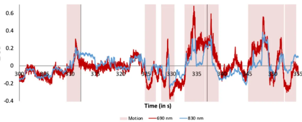 Fig. 3 Motion artifacts. Example motion artifacts (highlighted in pink) present during a segment of the time series for one channel for one participant