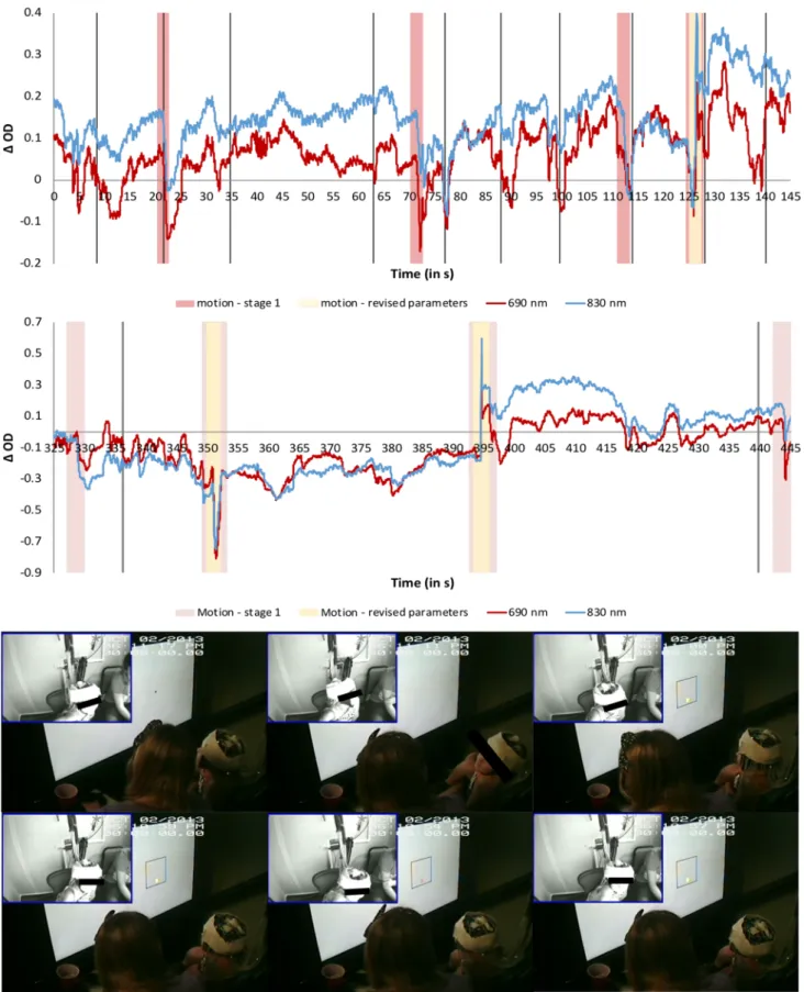 Fig. 4 Examples of motion artifacts (highlighted in pink for the parameters used in stage 1 and yellow for the revised parameters) present during a segment of the time series for one channel for one participant.