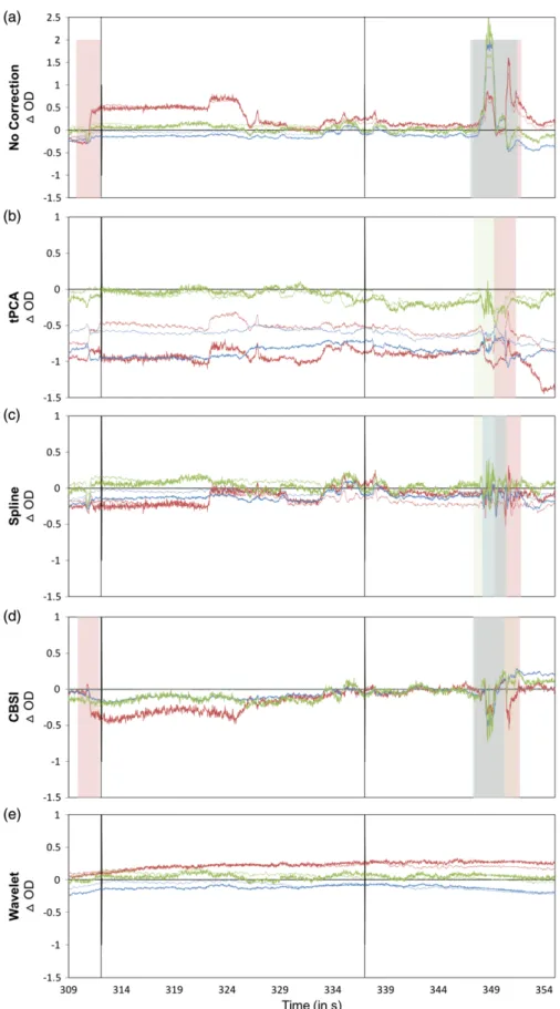 Fig. 7 Pre and postmotion correction. The figure depicts example channel before and after each motion processing technique is applied