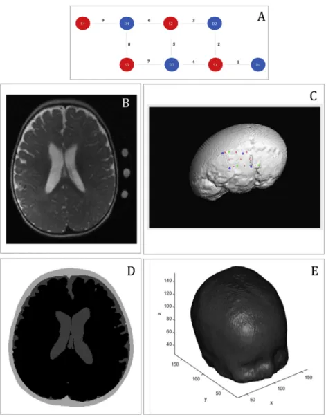 Fig. 2. Representation of the main methodological steps. A, Representation of the array