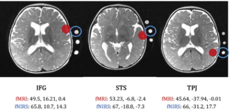 Fig. 4. Models representation of our 13 hypotheses. Grey arrows represent the ﬁxed intrinsic connections between the IFG, STS and TPJ; black arrows pointing at STS represent the input; blue lines represent the modulatory effect of NV and red lines the modu