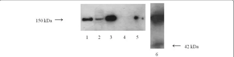 Table 3 Correlations between levels of urinary MAC and complement regulatory proteins in IgAN patients