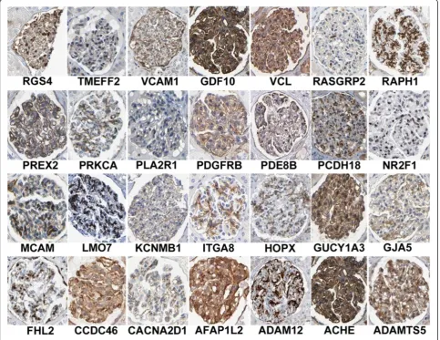 Figure 2 Immunohistochemistry showing glomerular expression patterns of some of the genes with elevated mesangial cellexpression